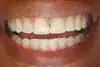 Periodontal Disease Dentist