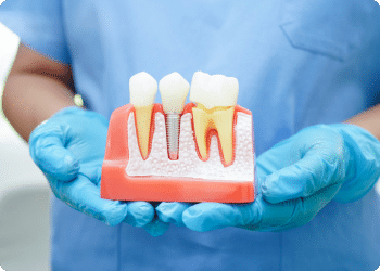 Prosthodontics & Restorations